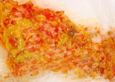 مدفوع نوزاد,انواع مدفوع نوزاد,مدفوع واقعی نوزاد